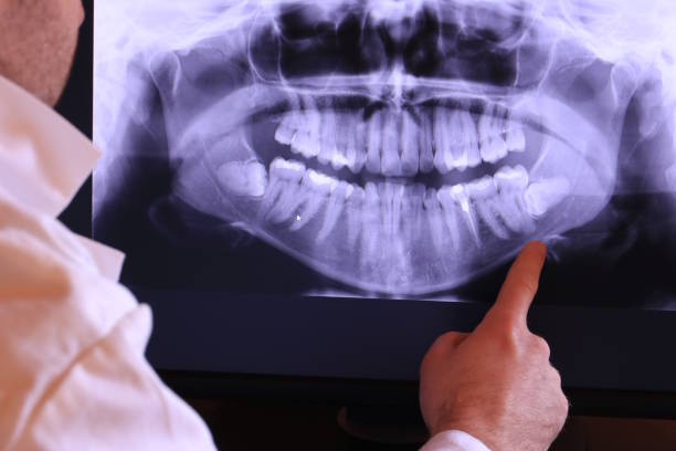 Best Emergency Gum Treatment in Newton, NJ