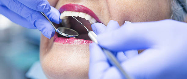 Best Emergency Wisdom Teeth Removal in Newton, NJ